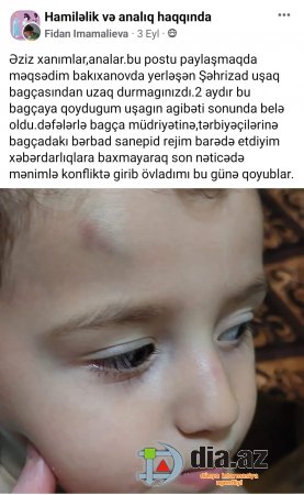 `Şəhrizad` uşaq bağçasında körpə bu hala salınır, amma əvəzində... `Şəhrizad` uşaq bağçasında körpə bu hala salınır, amma əvəzində...